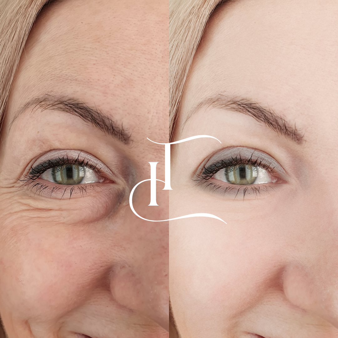 Especialista-em-Harmonizacao-Facial-2-1