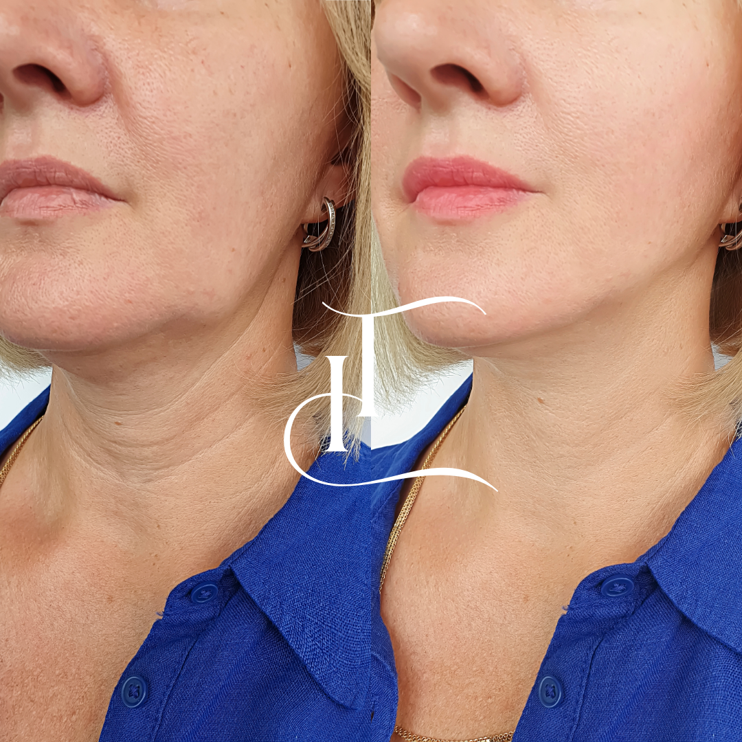 Especialista-em-Harmonizacao-Facial-5-1